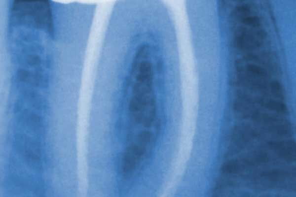 Endodontie Endodontie